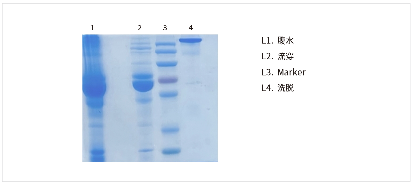 小鼠腹水电泳图.png